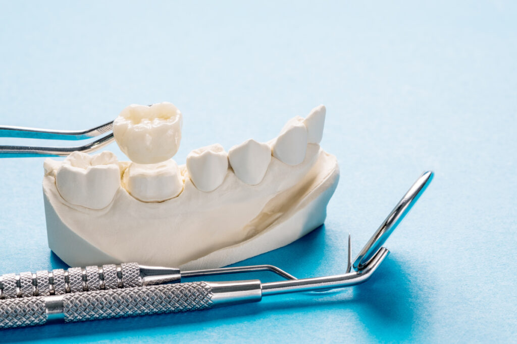 Prosthodontics or Prosthetic