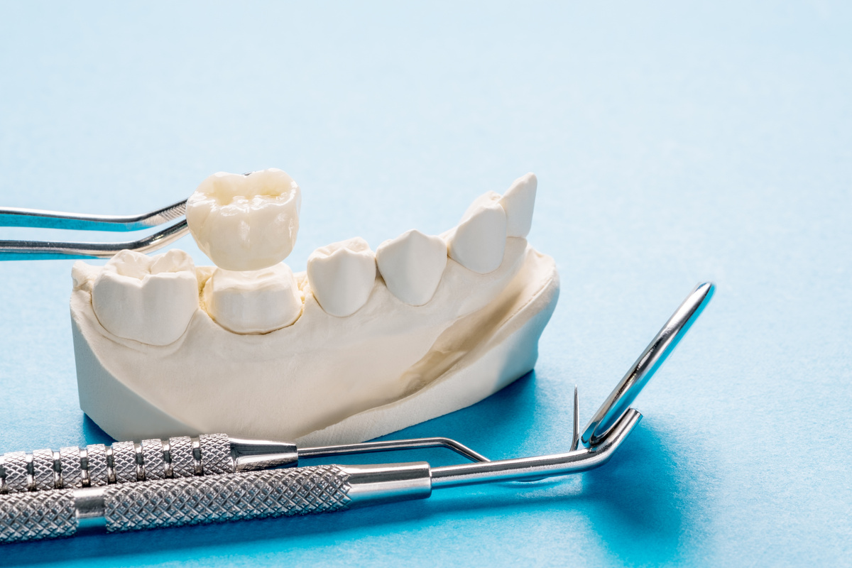 Prosthodontics or Prosthetic