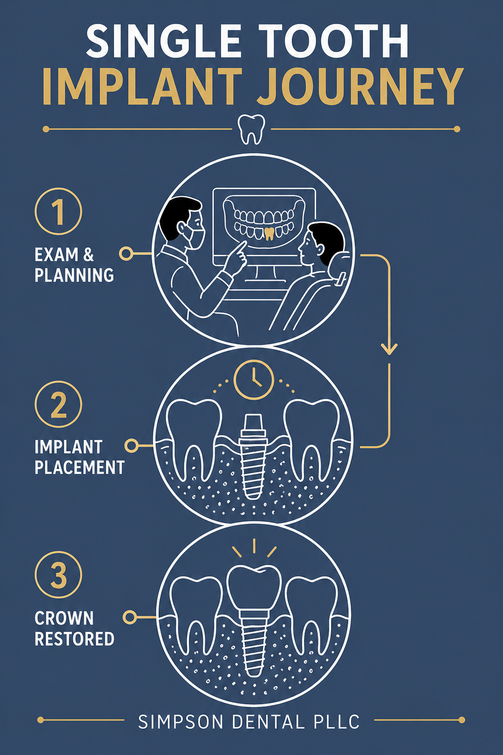 Infographic comparing single tooth implants vs full arch restoration options at Simpson Dental